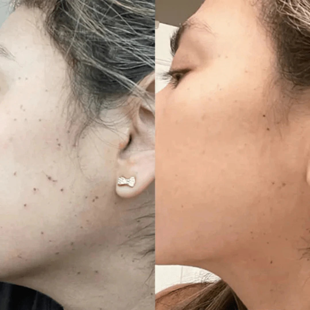 Swissclear Plasma Pen