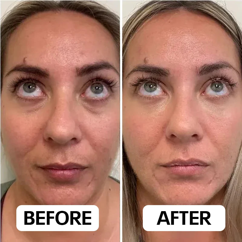 Neux Radiance™ Handset by Neoclear