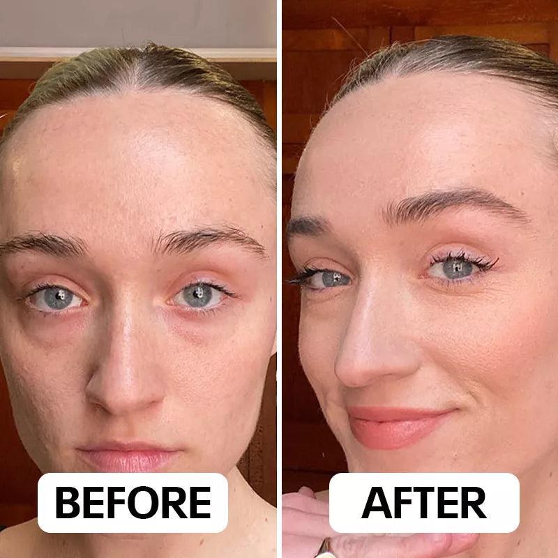 Neux Radiance™ Handset by Neoclear