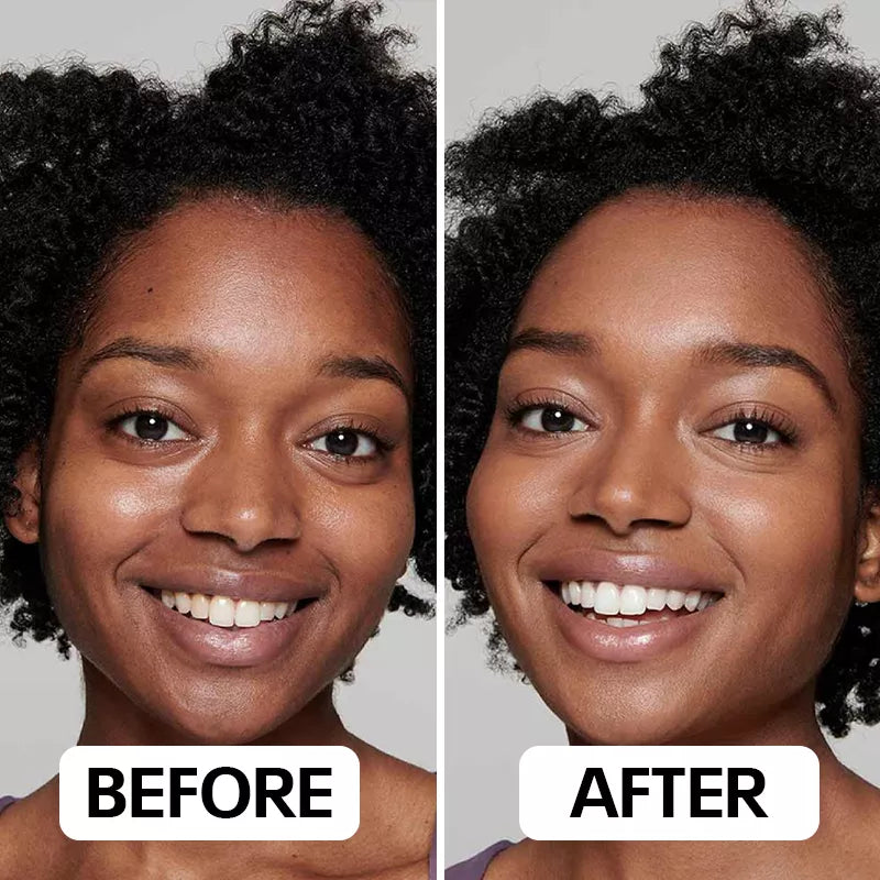 Neux Radiance™ Handset by Neoclear