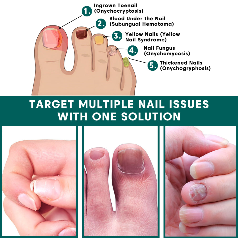 Swissclear Antifungal Pen